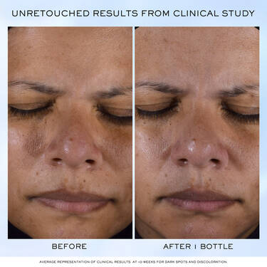 Clarifique Pro-Solution Serum